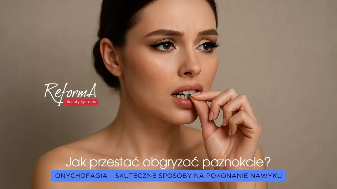 Obgryzanie skórek - Jak przestać? Skuteczne metody i porady