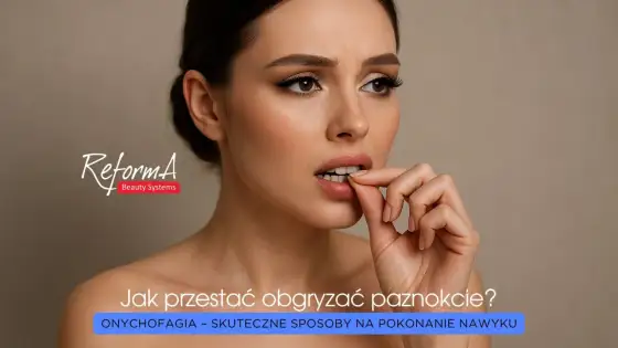 Obgryzanie skórek - Jak przestać? Skuteczne metody i porady
